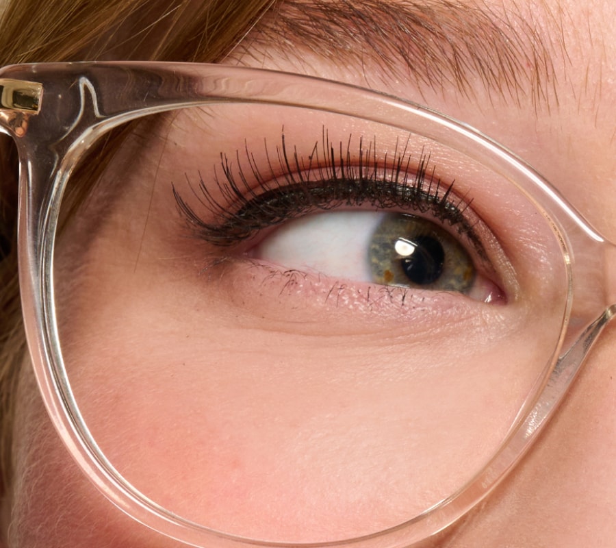 A closeup with an eye with an eyeglass lens
