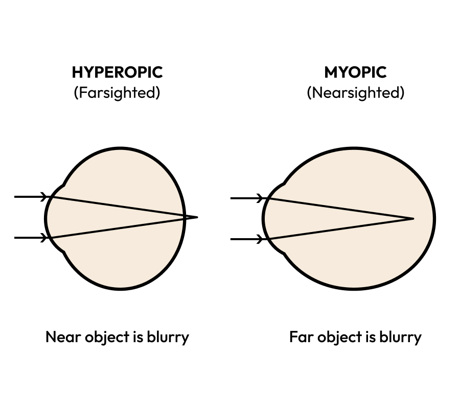 Nearsighted Vs Farsighted What s The Difference Blog Eyebuydirect