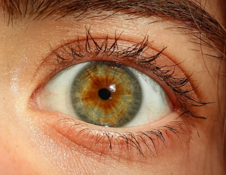 A closeup of hazel-colored eyes