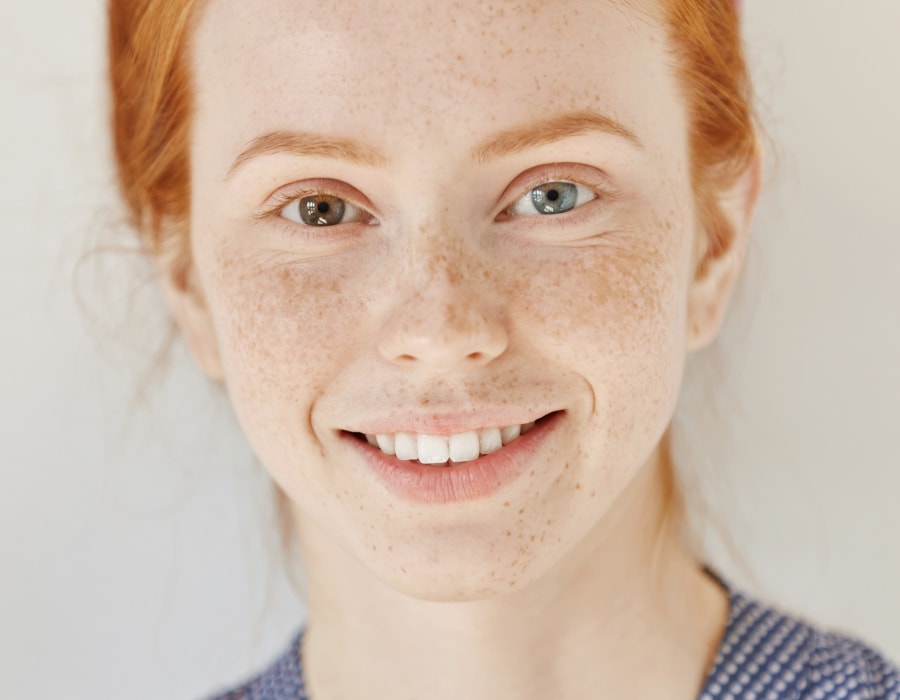 A woman with red hair and heterochromia