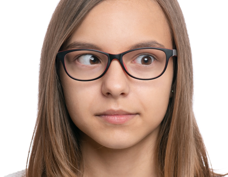 A girl wearing glasses presenting strabismus