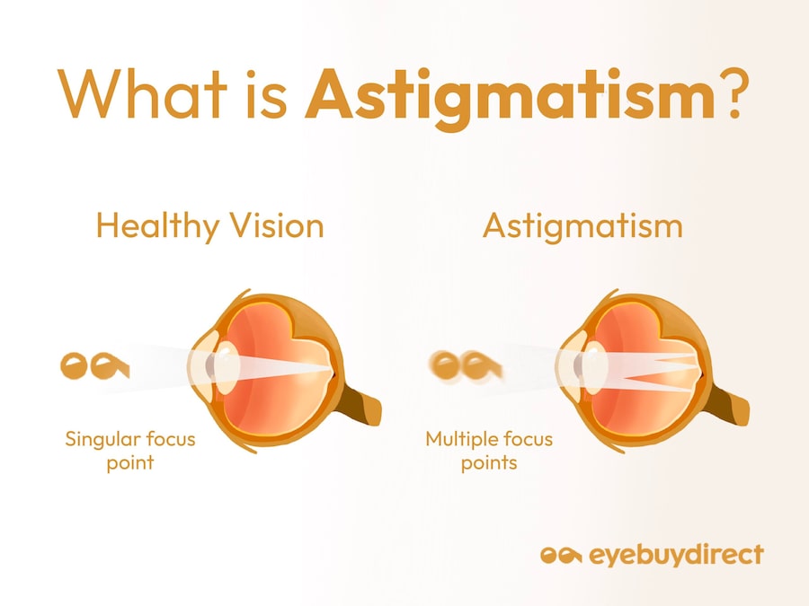 An infographic showing how astigmatism works