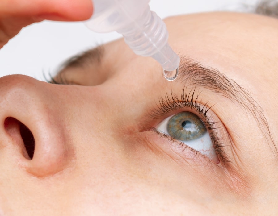A closeup of someone applying eyedrops into their left eye
