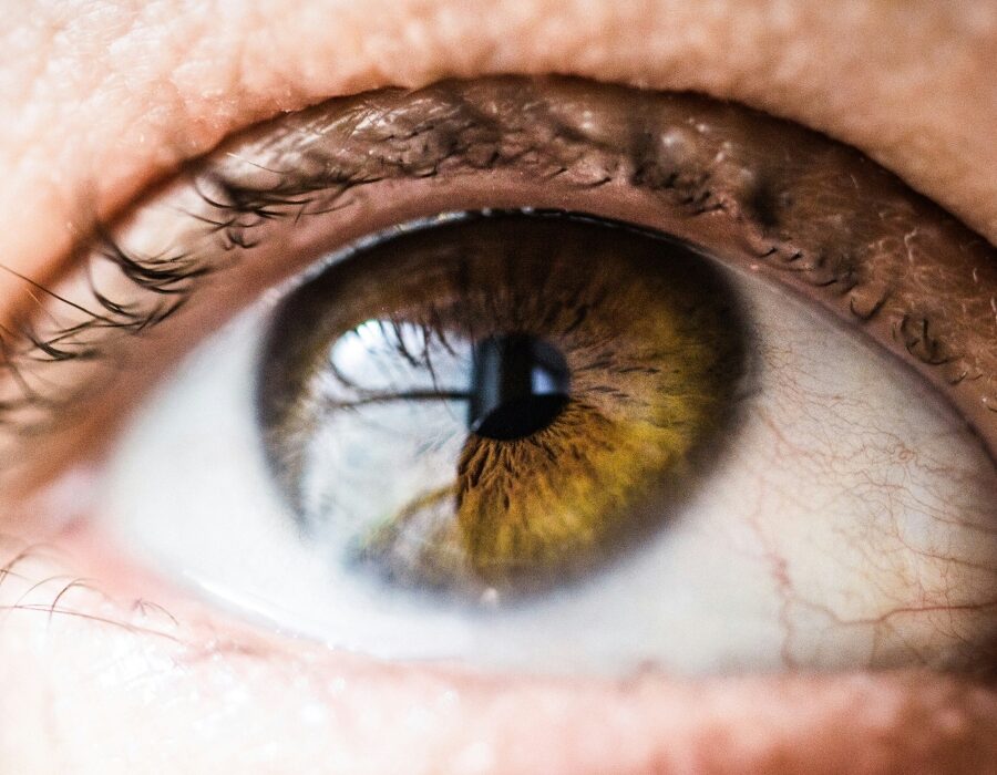 A closeup of a light-brown eye