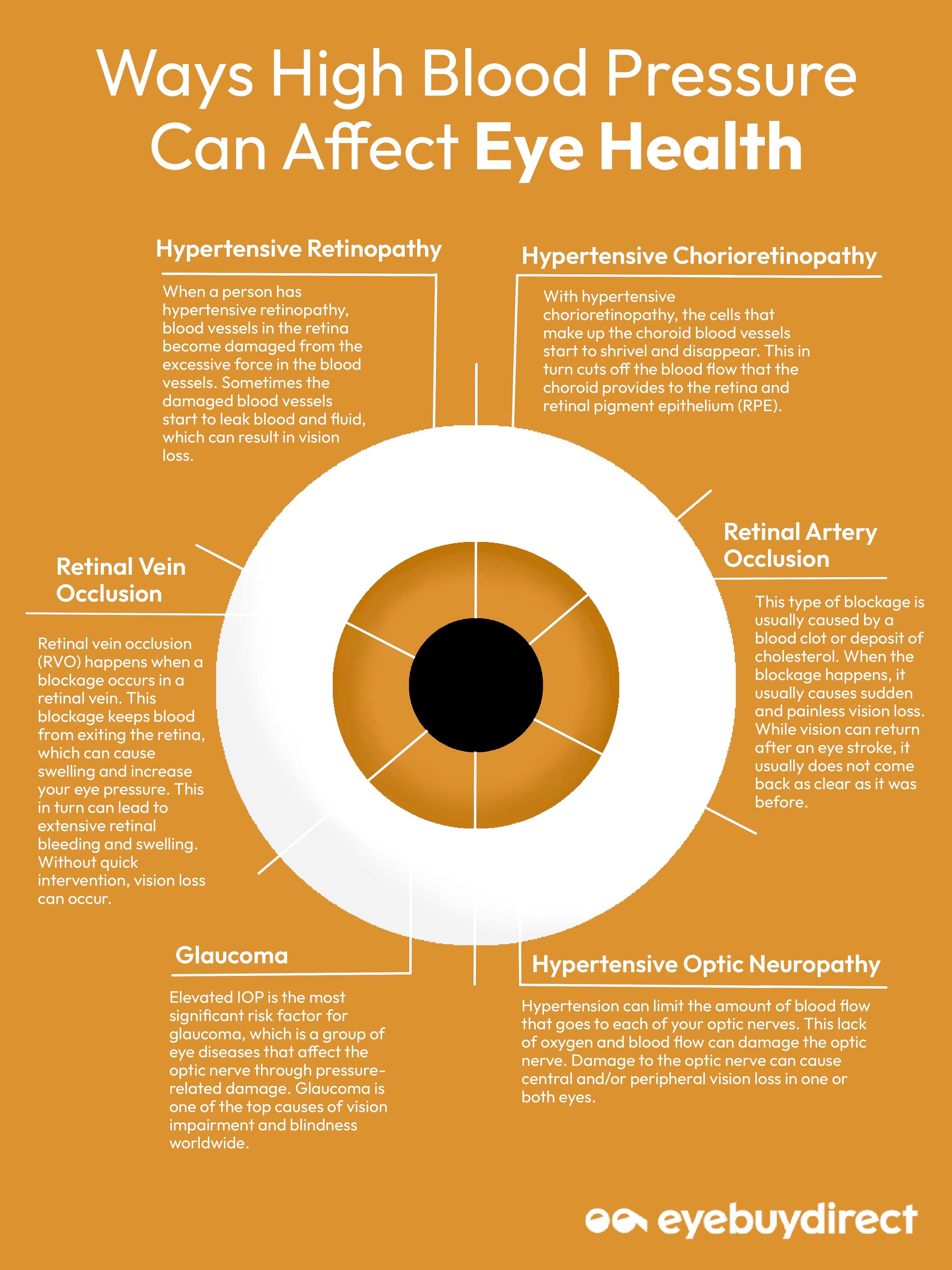 Can High Blood Pressure Affect Your Vision Eyebuydirect Canada