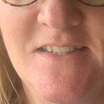 Mary B. F. - Pink Floral - horn - plastic